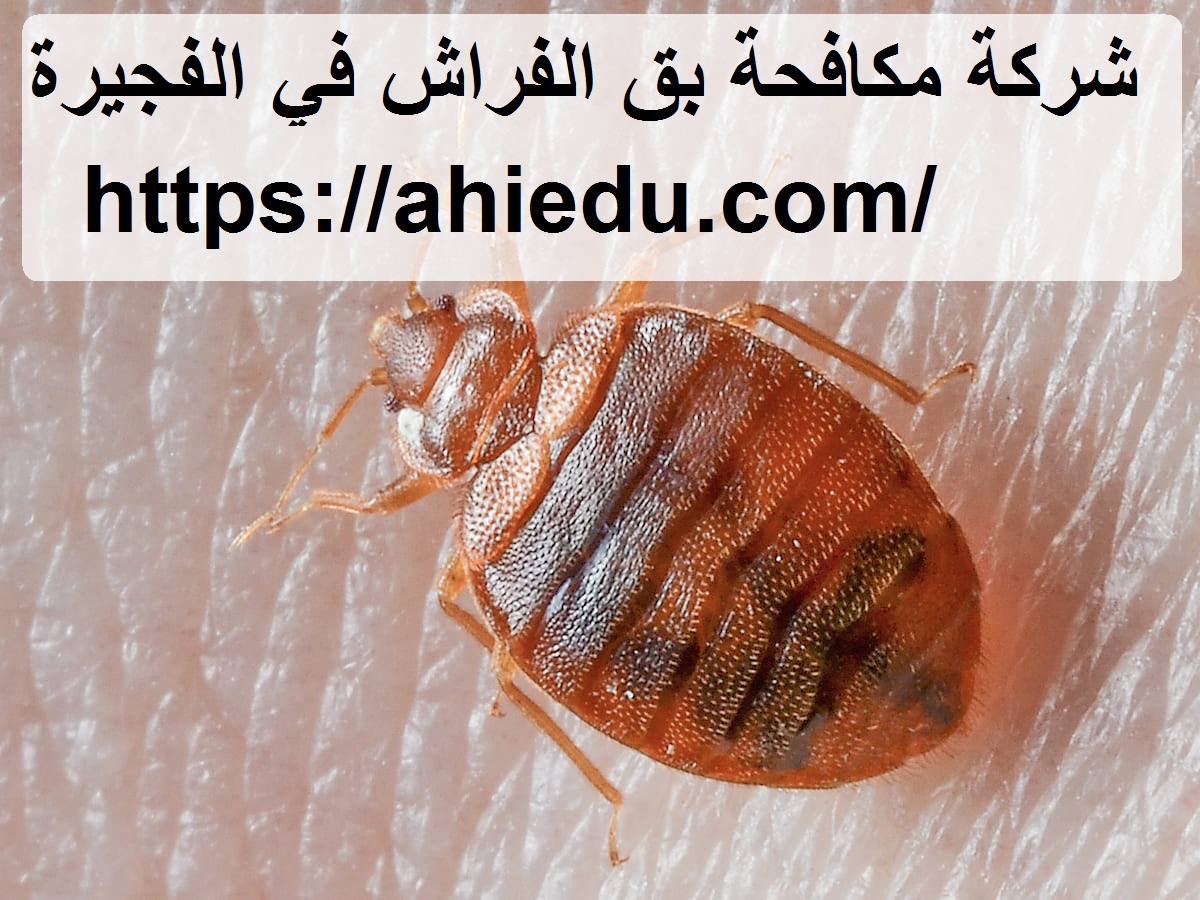شركة مكافحة بق الفراش في الفجيرة